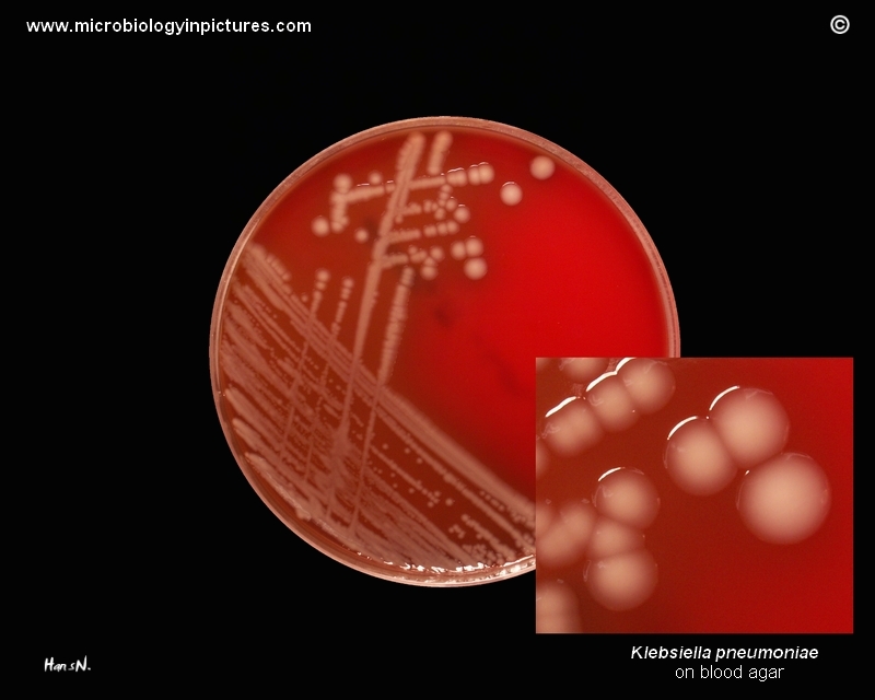 K.pneumoniae in Petri dish